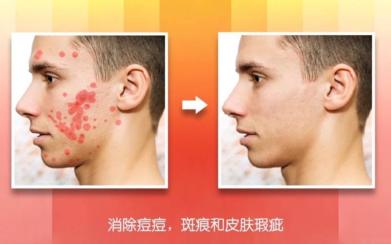 修图神器去水印除瑕疵修复照片