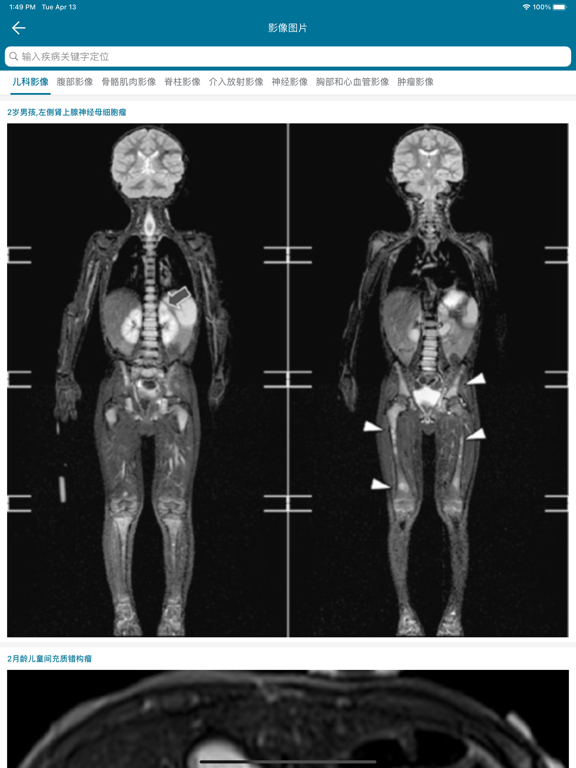 临床精钥ClinicalKey